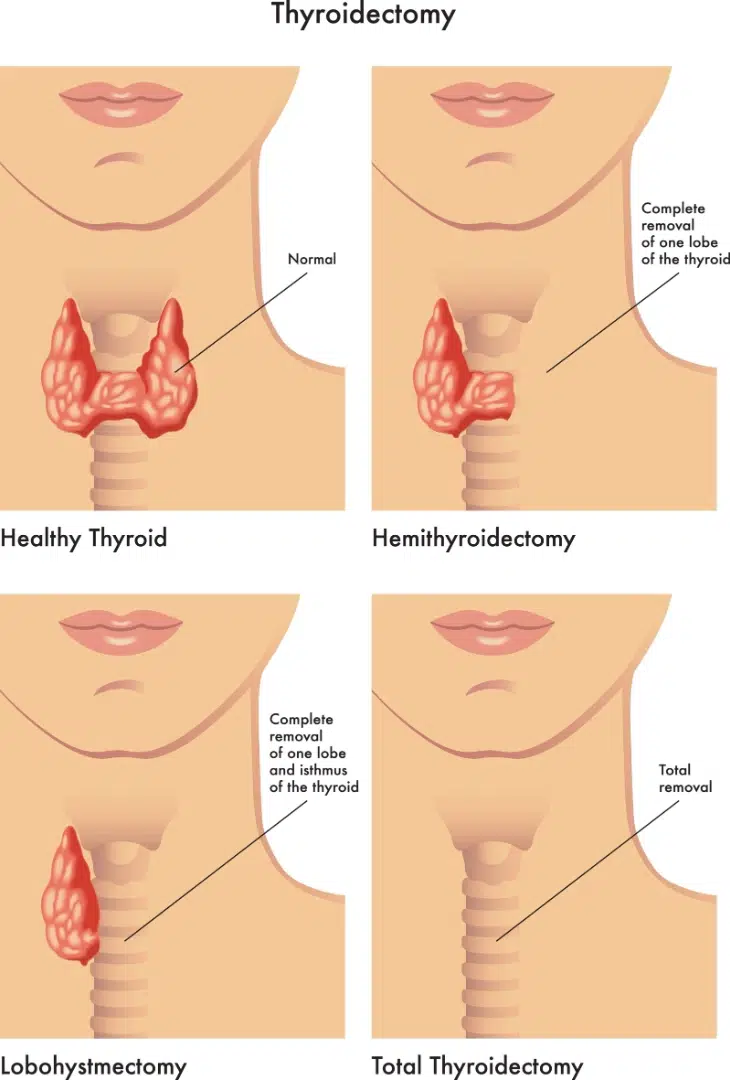 Neck Lump Check: What It Means and When to See a Doctor