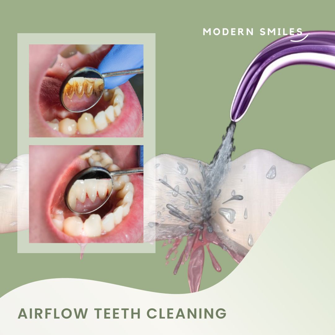 Oral Prophylaxis: Quick Guide to Benefits, Cost & Care
