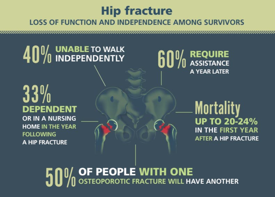 Osteoporosis Hip Fracture: Key Facts You Need to Know