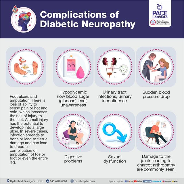 Peripheral Neuropathy Complications Explained Guide