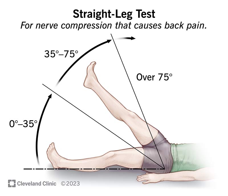 Sciatica Diagnosis: Quick Ways to Pinpoint Your Pain
