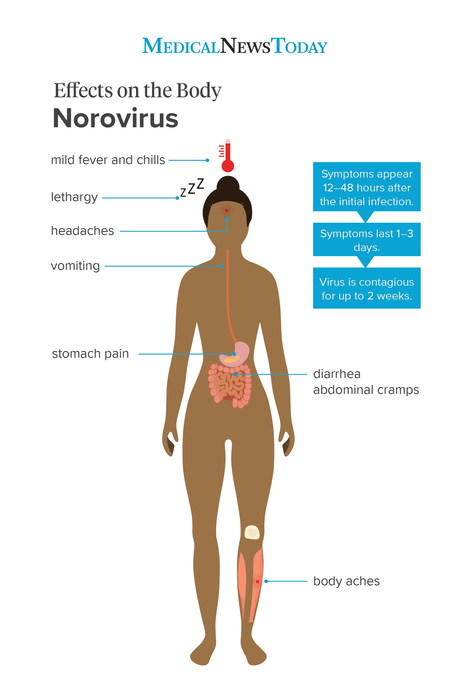 Stomach Bug Types: Causes, Symptoms & Treatment Guide