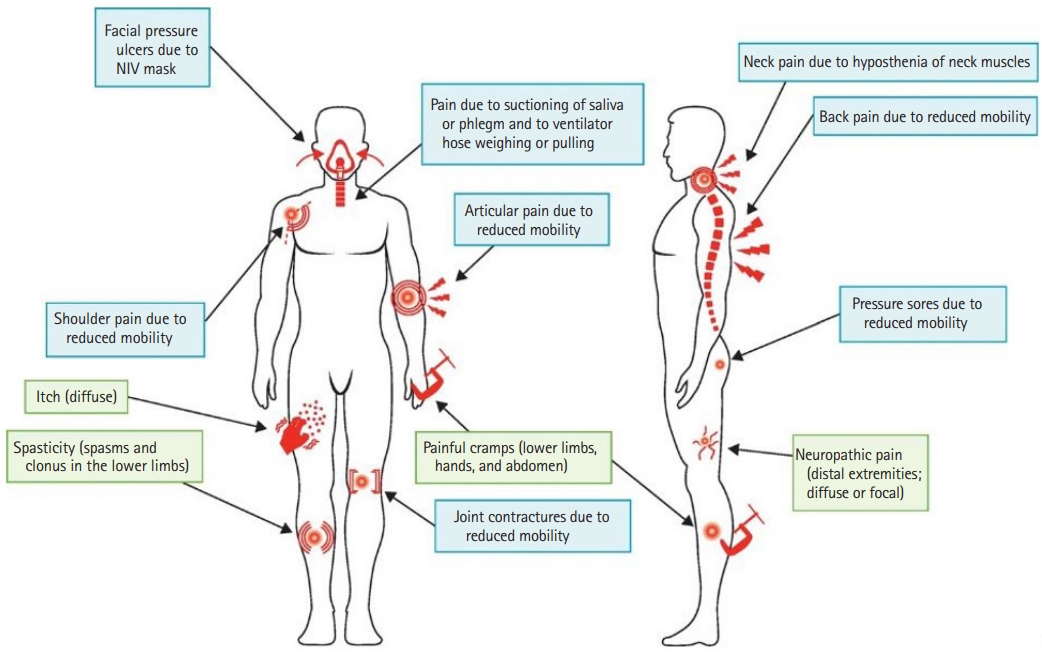 Understanding ALS Muscle Cramps: Feel, Timing & Relief
