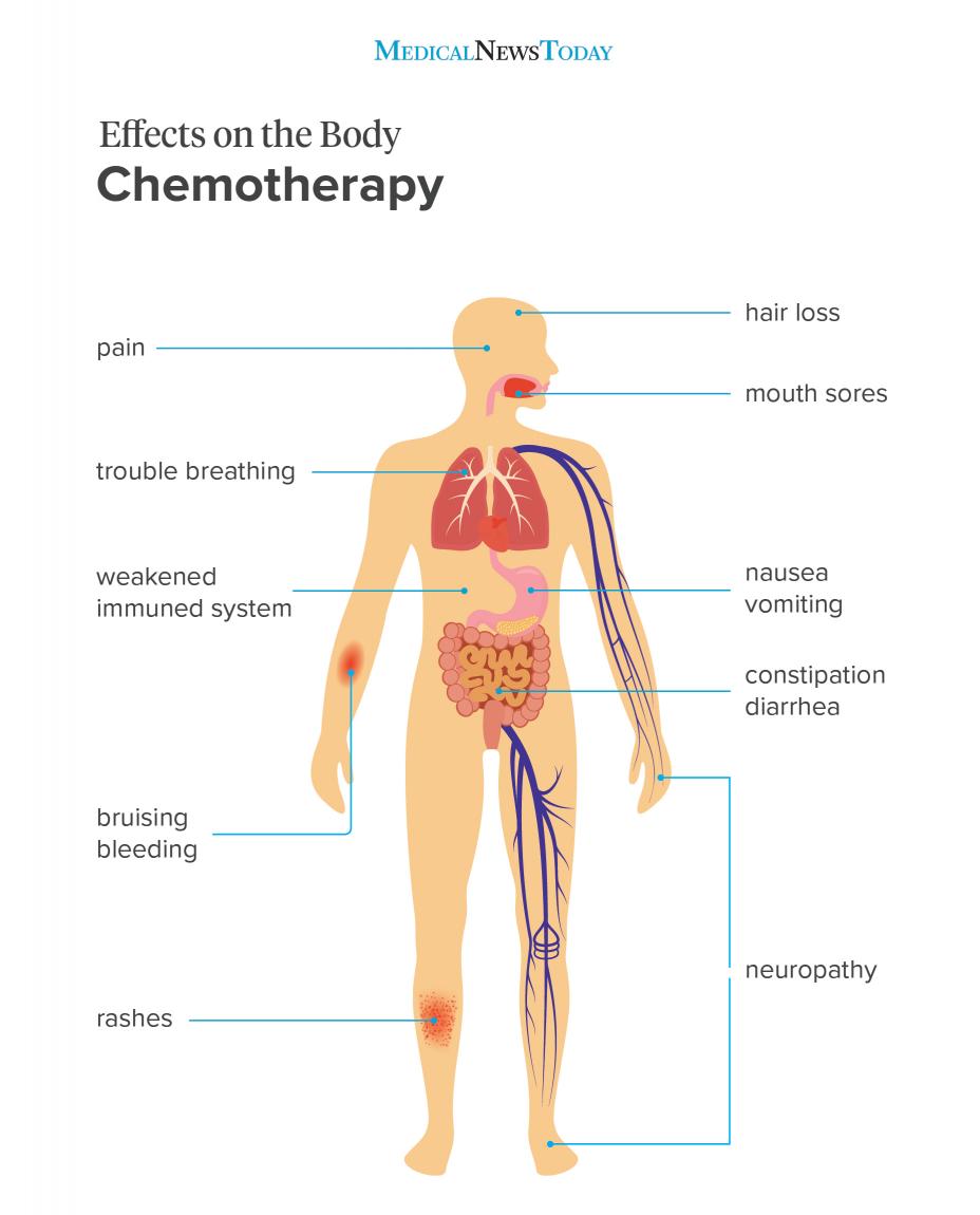 Chemotherapy Effects: What to Expect, Manage & Thrive