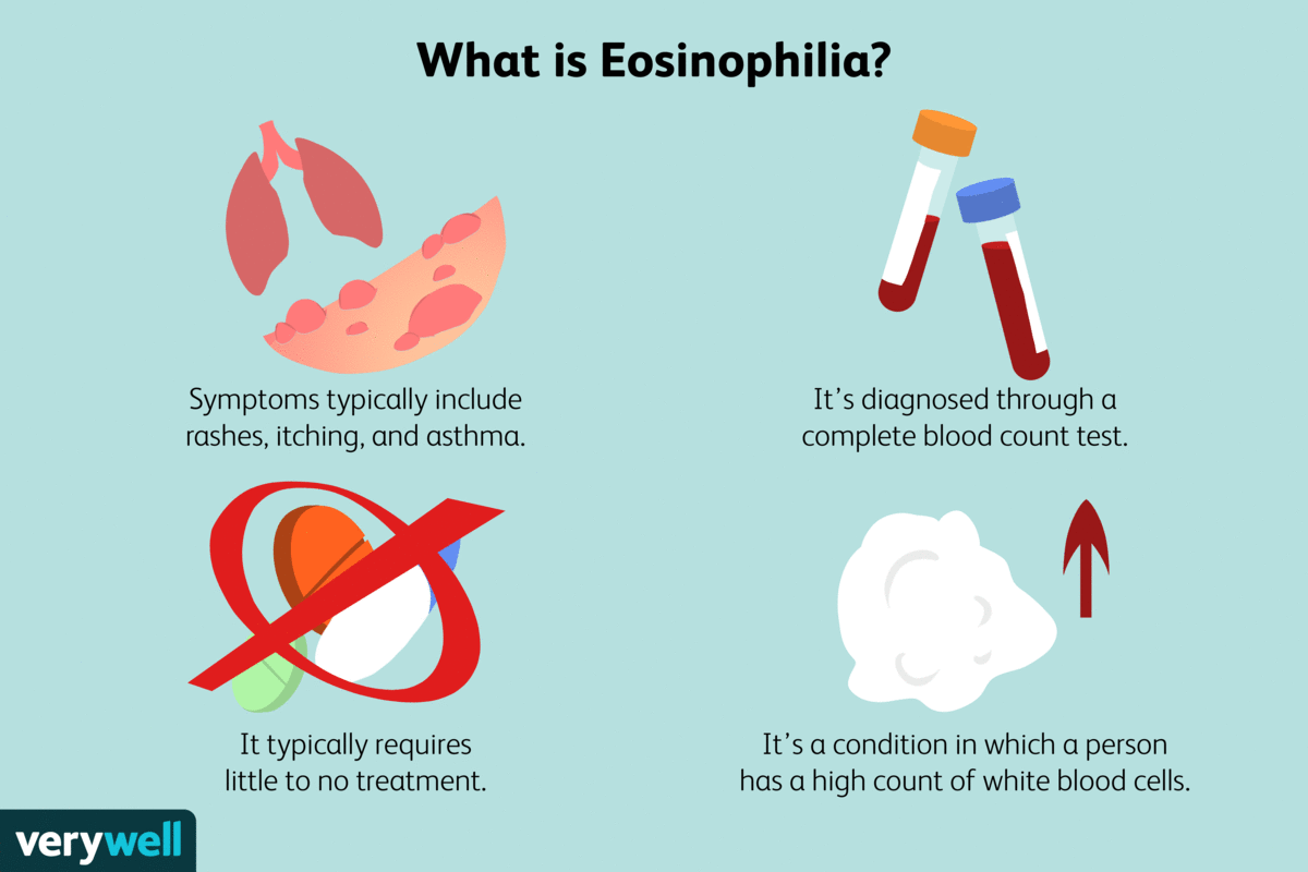 Eosinophilia Myalgia Diagnosis: How Doctors Identify It