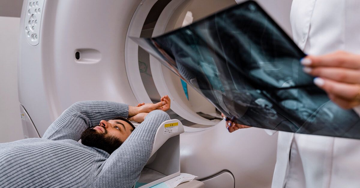 External Beam Radiation Esophagus: Quick Guide