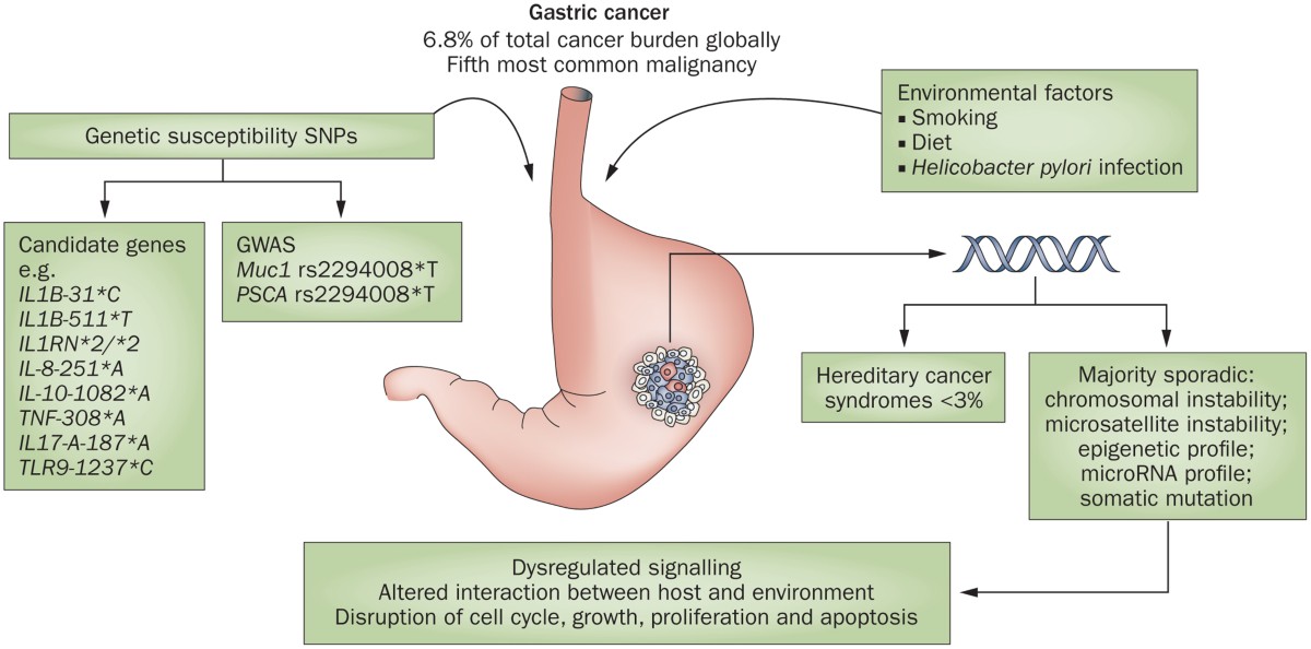 Genetic Stomach Cancer: What You Need to Know Now
