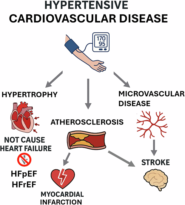 Hypertensive Heart Disease Symptoms – Watch For Them