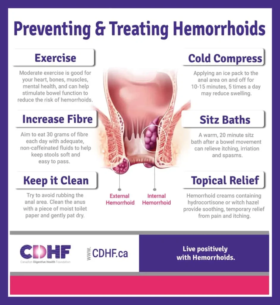 Effective Itchy Hemorrhoid Treatment: Fast Relief Tips