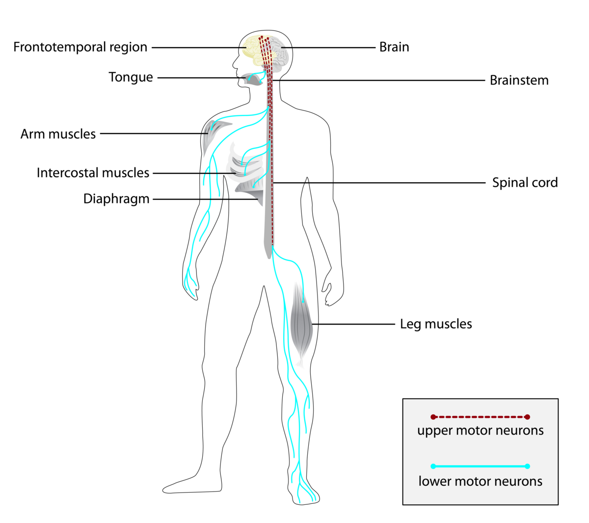Neuropathy and ALS: Key Differences, Overlap & Signs