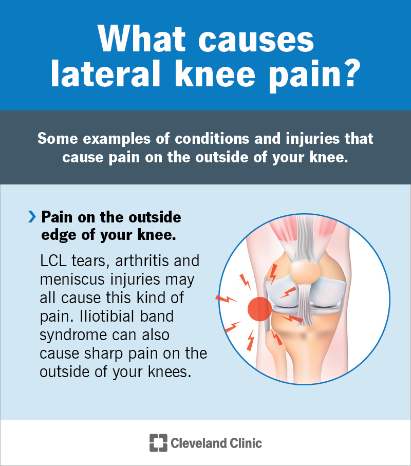 Outside Knee Injury: Causes, Symptoms & Treatment