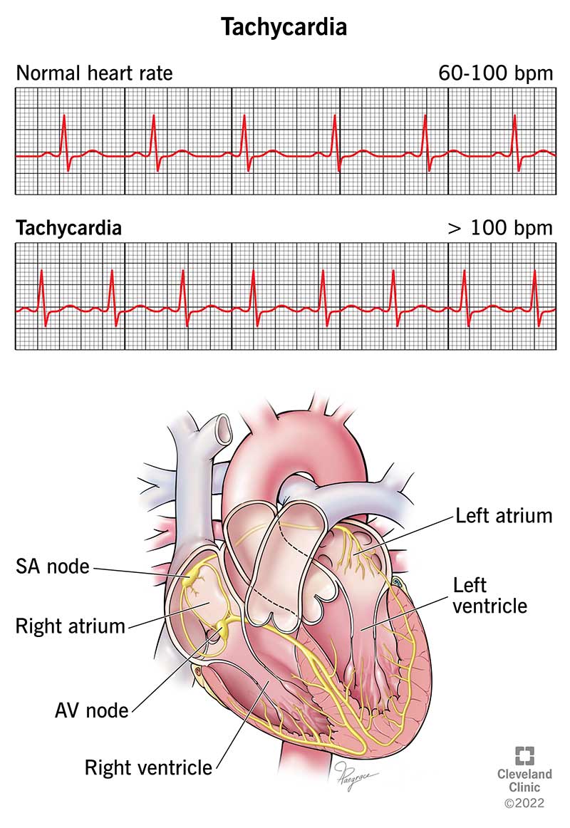 Smoking Tachycardia: Why Your Heart Beats Faster