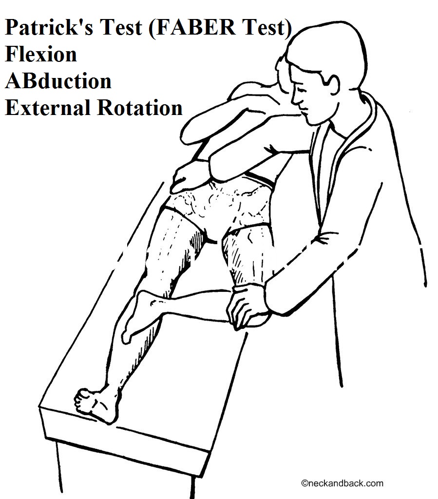 Ankylosing Spondylitis Diagnosis Quiz: Quick Self‑Check for Early Warning