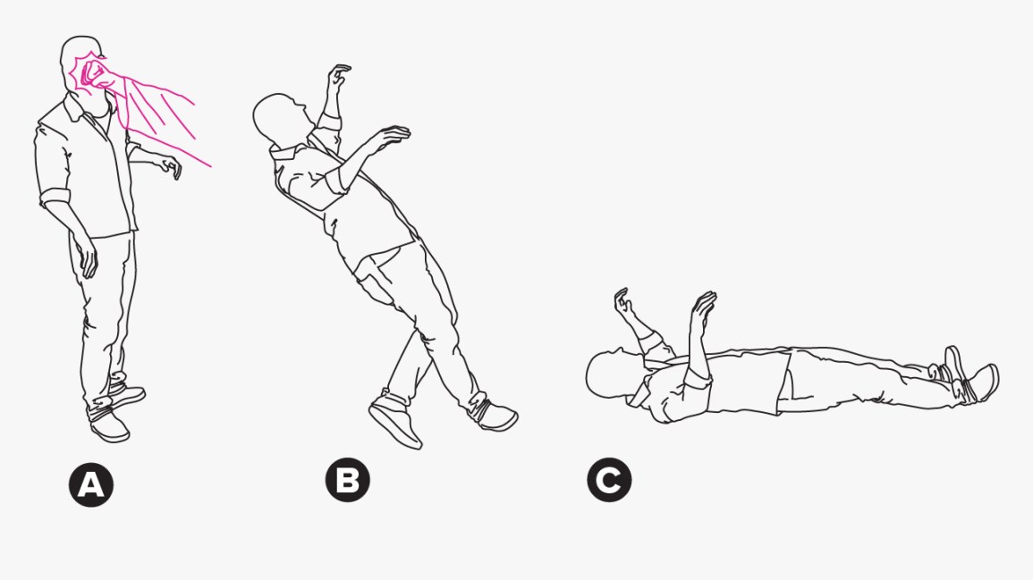 Fencing Response Fingers: What They Mean & What to Do