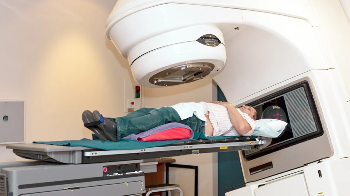 Radiation and Hormone Therapy for Prostate Cancer