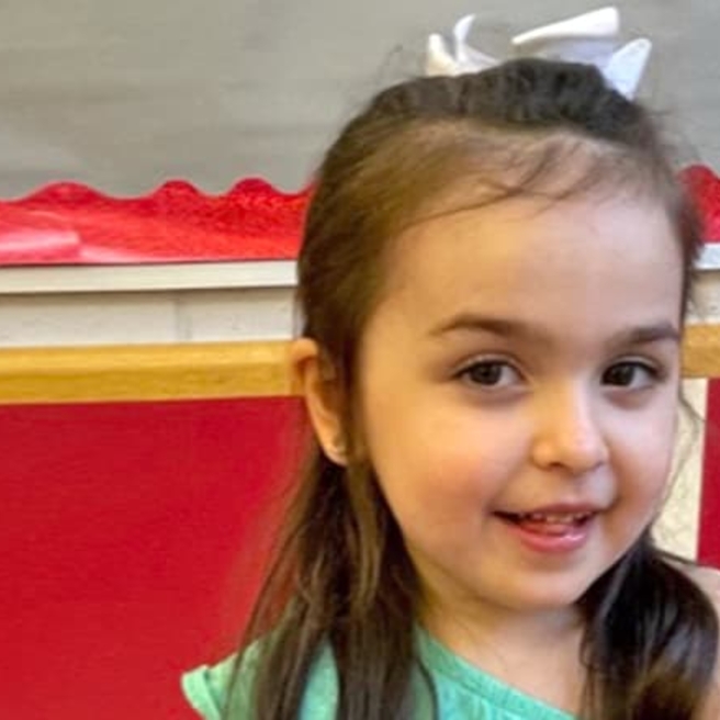 Rett Syndrome Facial Features: What You Need to Know