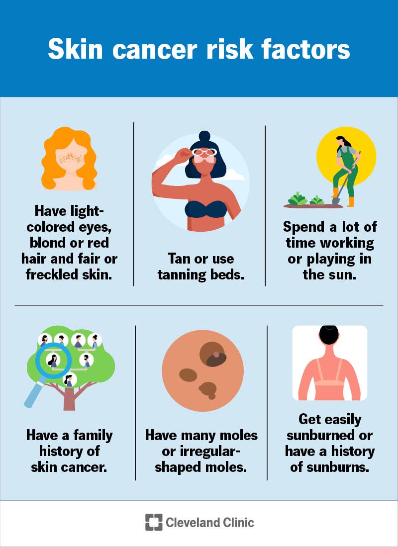 Skin Cancer Symptoms Pictures: What to Look For