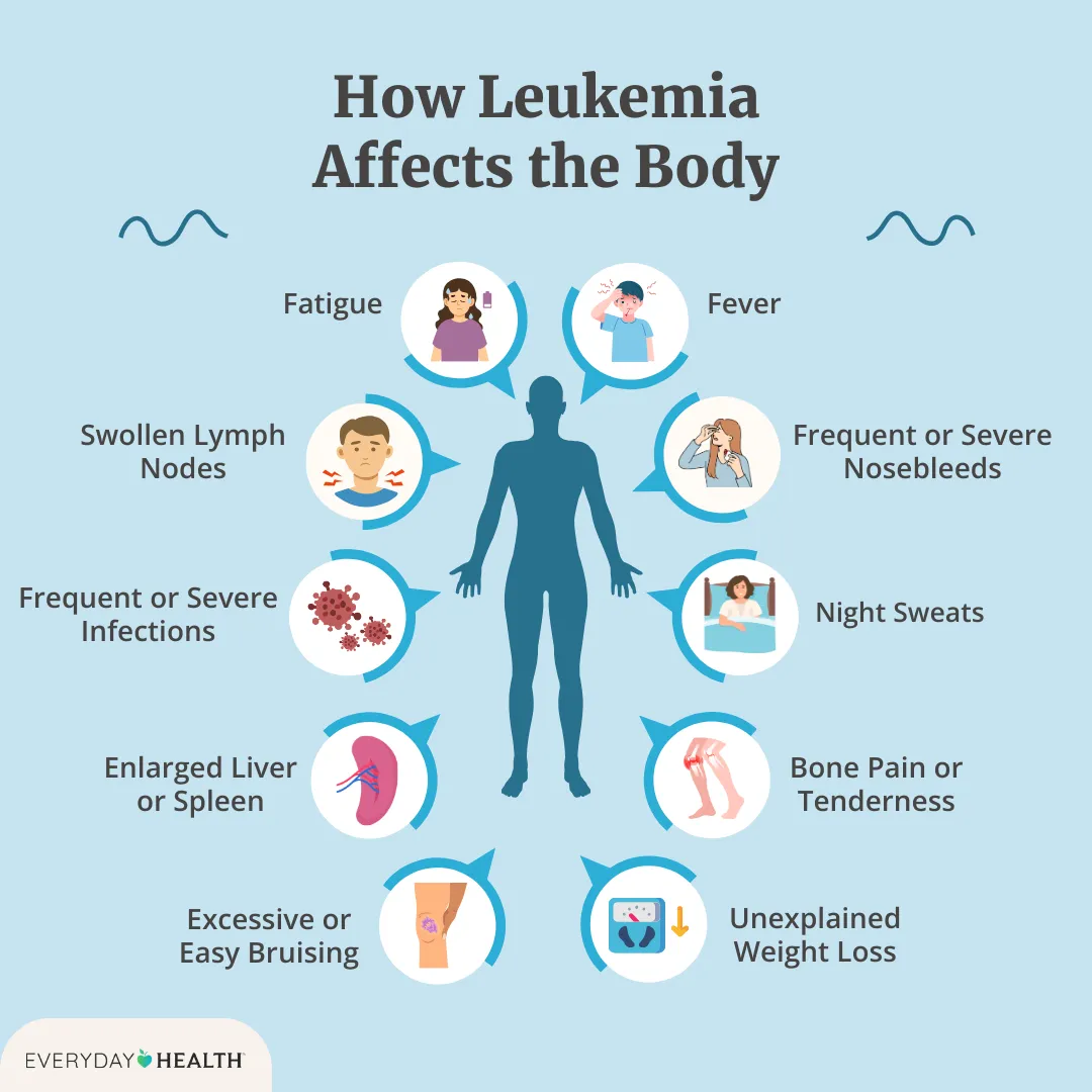 Symptoms of Leukemia in Females – Key Early Signs