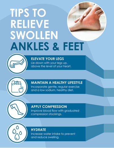 Effective Treatment for Swelling in Legs and Feet