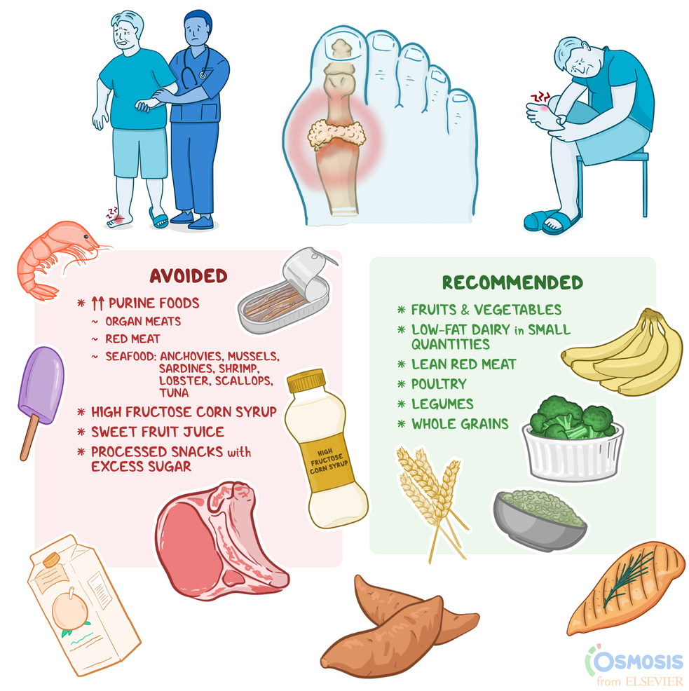 Vegetables to Avoid with Gout – Quick Expert Guide
