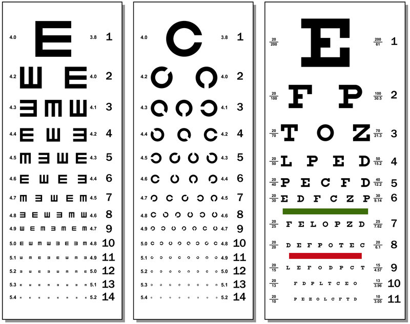 Cataract Eye Test Chart: Guide to Spot Vision Changes