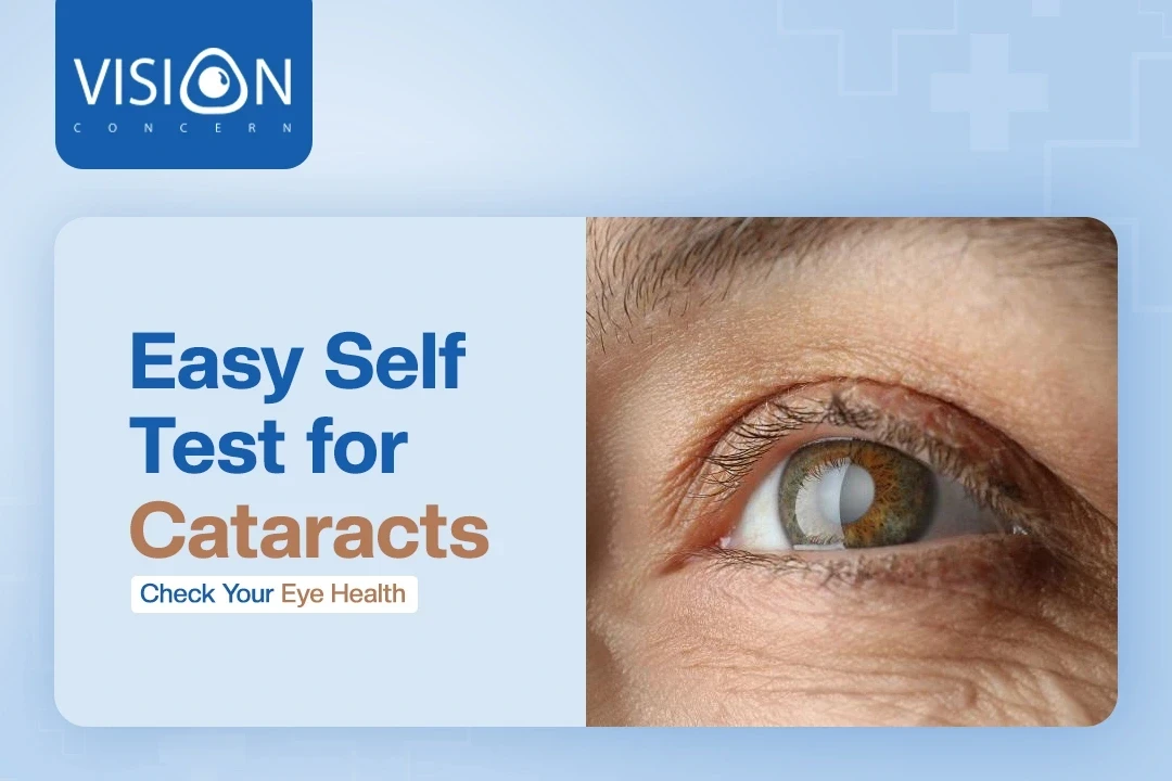 Self-Test for Cataracts – Quick, Free Home Eye Check