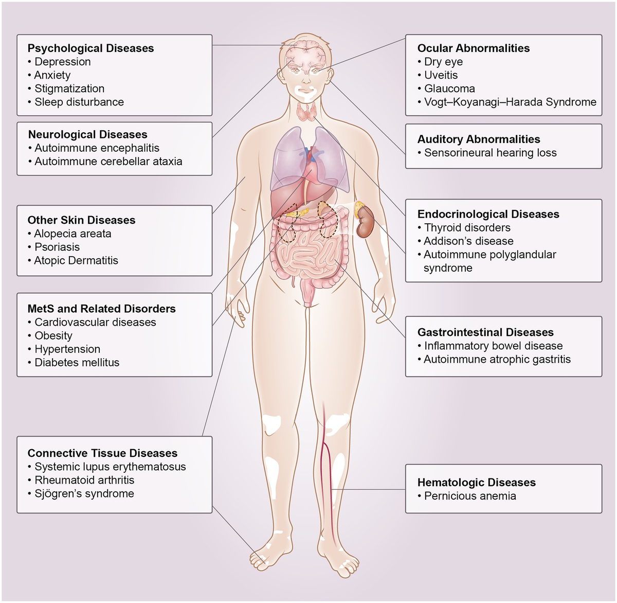 Vitiligo and Other Autoimmune Diseases – Key Facts