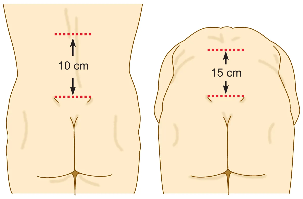 Ankylosing Spondylitis Test: What It Is & Why