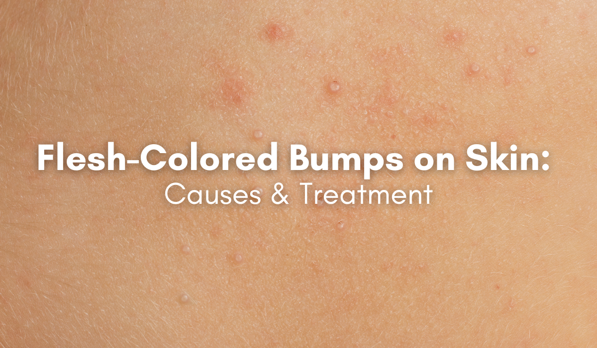 Bumps on Skin Pictures: Spot, Understand & Act Fast