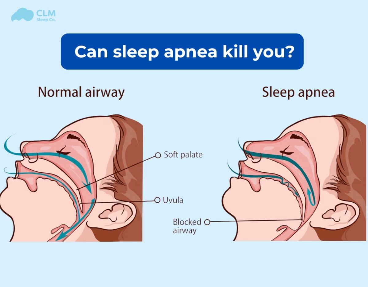 Can Sleep Apnea Kill You? Risks, Signs & How to Protect Yourself