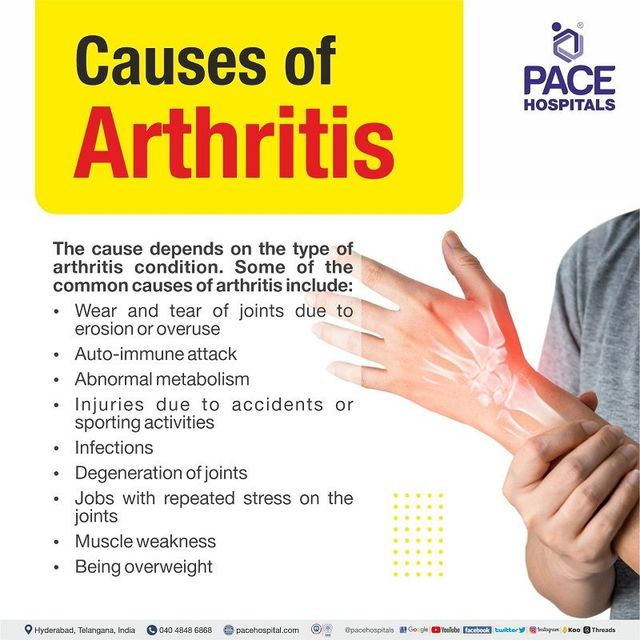 Understanding the Causes of Arthritis: A Friendly Guide