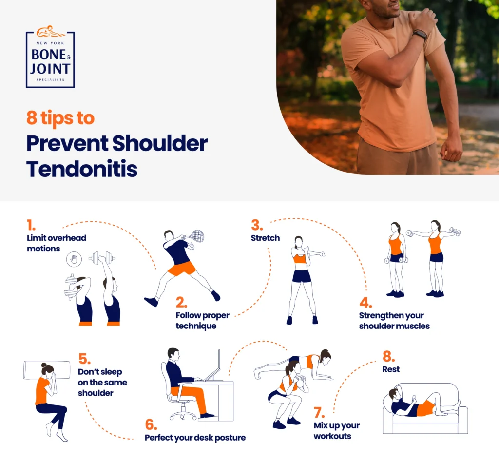 How to Prevent Shoulder Ankylosis: Simple Proven Steps