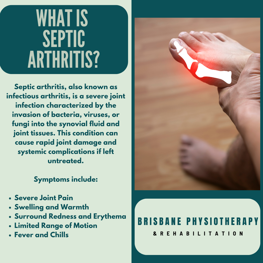 Long‑Term Effects of Septic Arthritis Explained