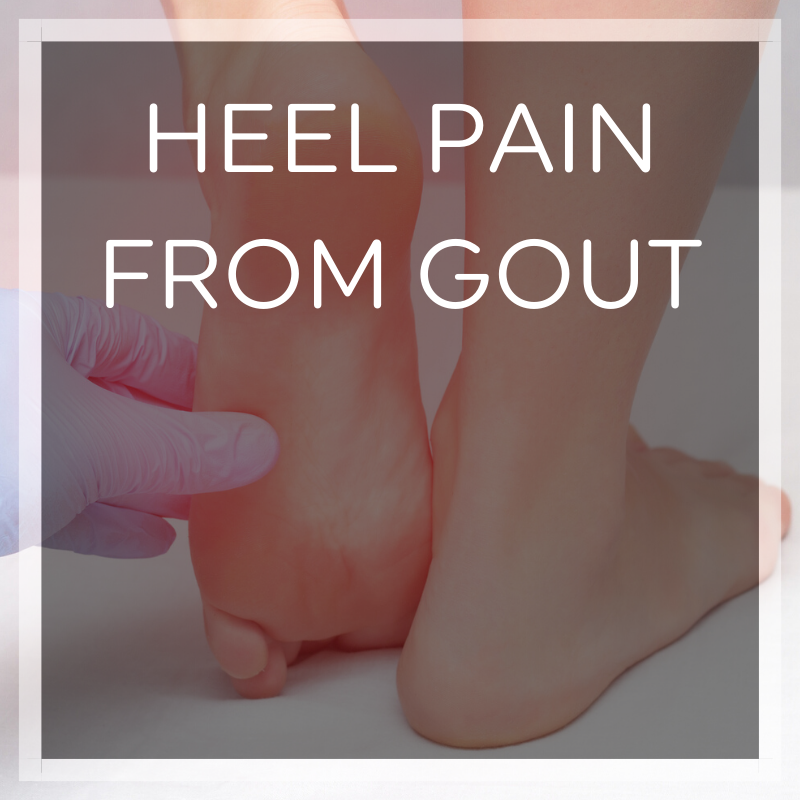 Pictures of Gout in Heel: How to Spot & Treat