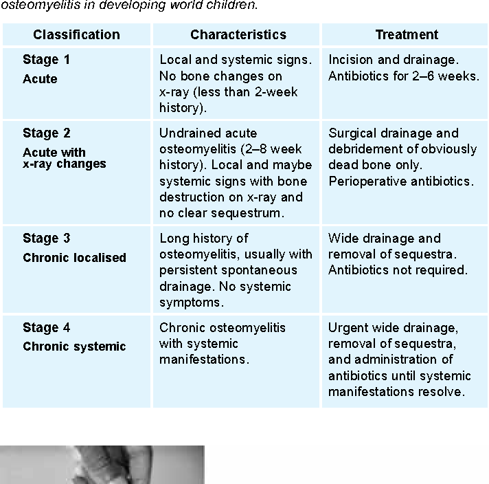 Septic Arthritis vs Osteomyelitis: Quick Diagnosis Guide