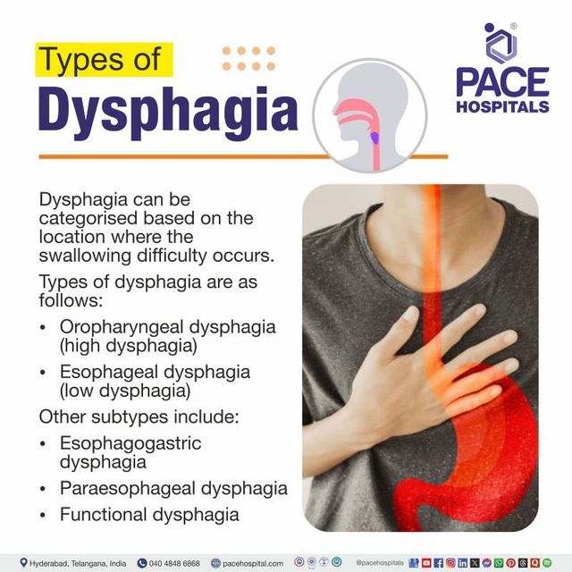 Types of Dysphagia – Causes, Symptoms & Risks