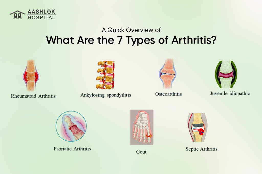 What are the 7 Types of Arthritis? Quick Guide