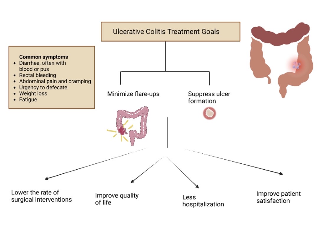 What Is the Latest Treatment for Ulcerative Colitis?