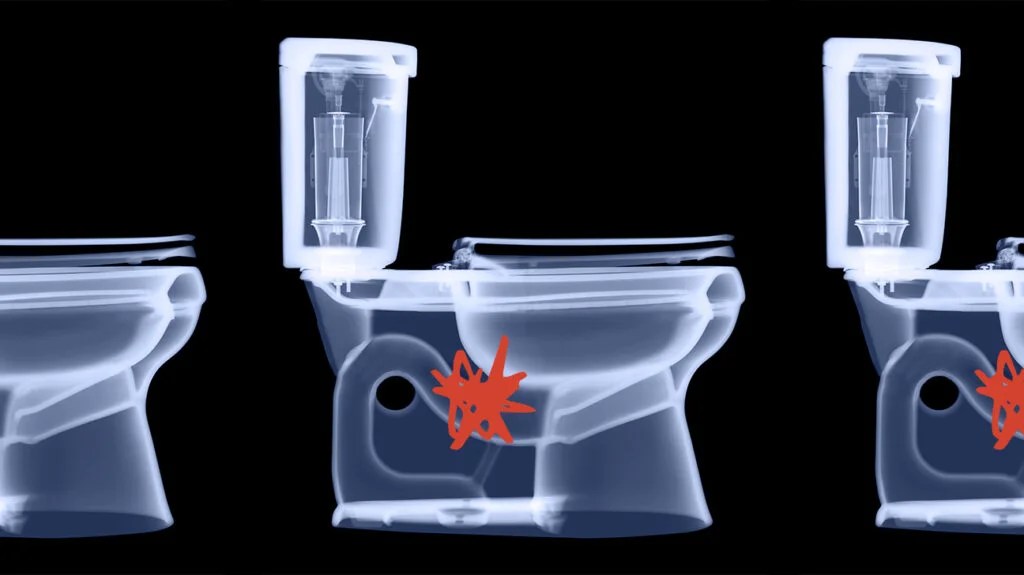 Why Is My Poop So Big It Clogs the Toilet?
