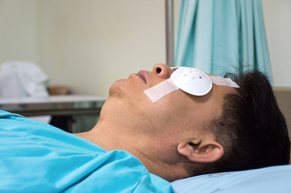 How Long to Wear Eye Shield at Night After Cataract Op