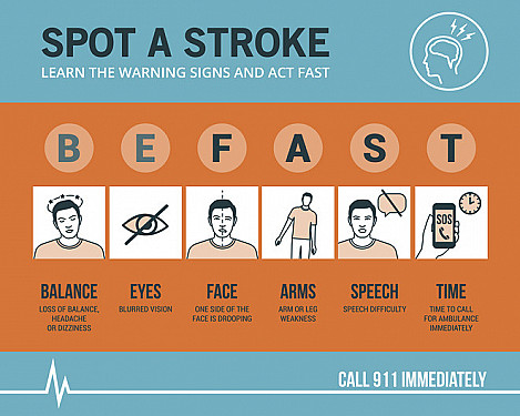 How to Avoid Stroke After COVID: Proven Steps
