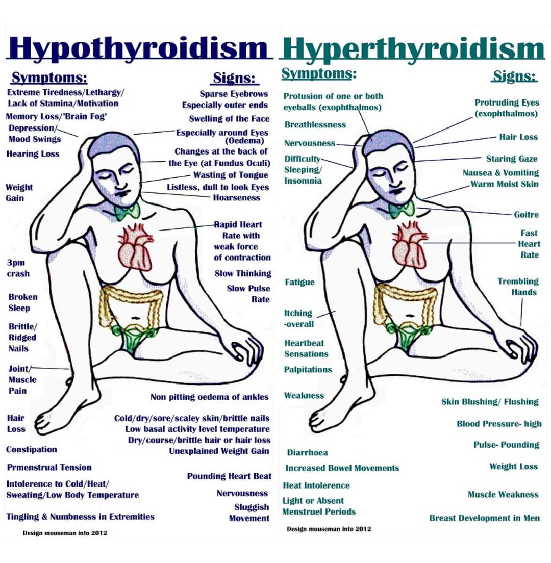 Hypothyroidism Fatigue Reddit: Real Stories & Tips