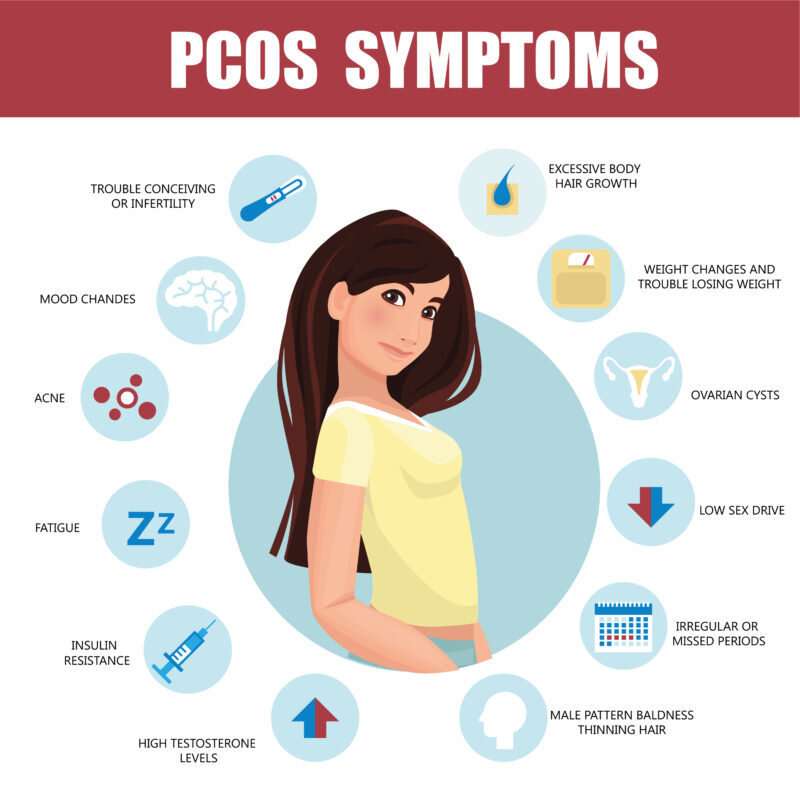 PCOS Symptoms and Treatment: What You Need to Know