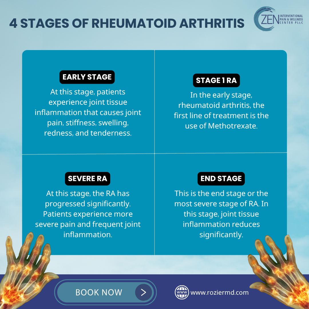 Rheumatoid Arthritis: When to Stop Working Safely