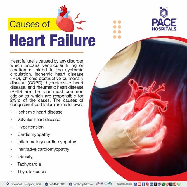What Are the 4 Main Causes of Heart Failure? Explained