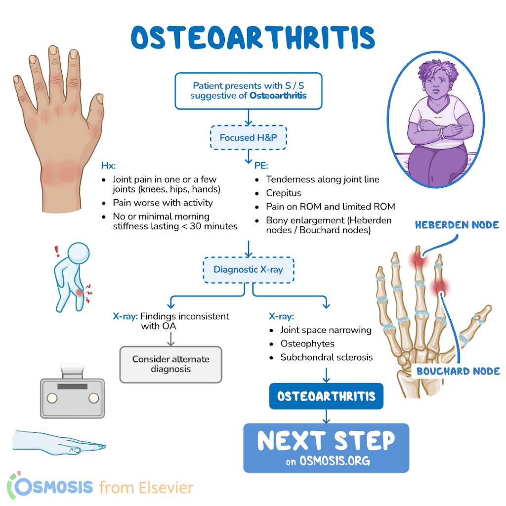 Osteoarthritis Diagnosis: Your Clear Path to Relief