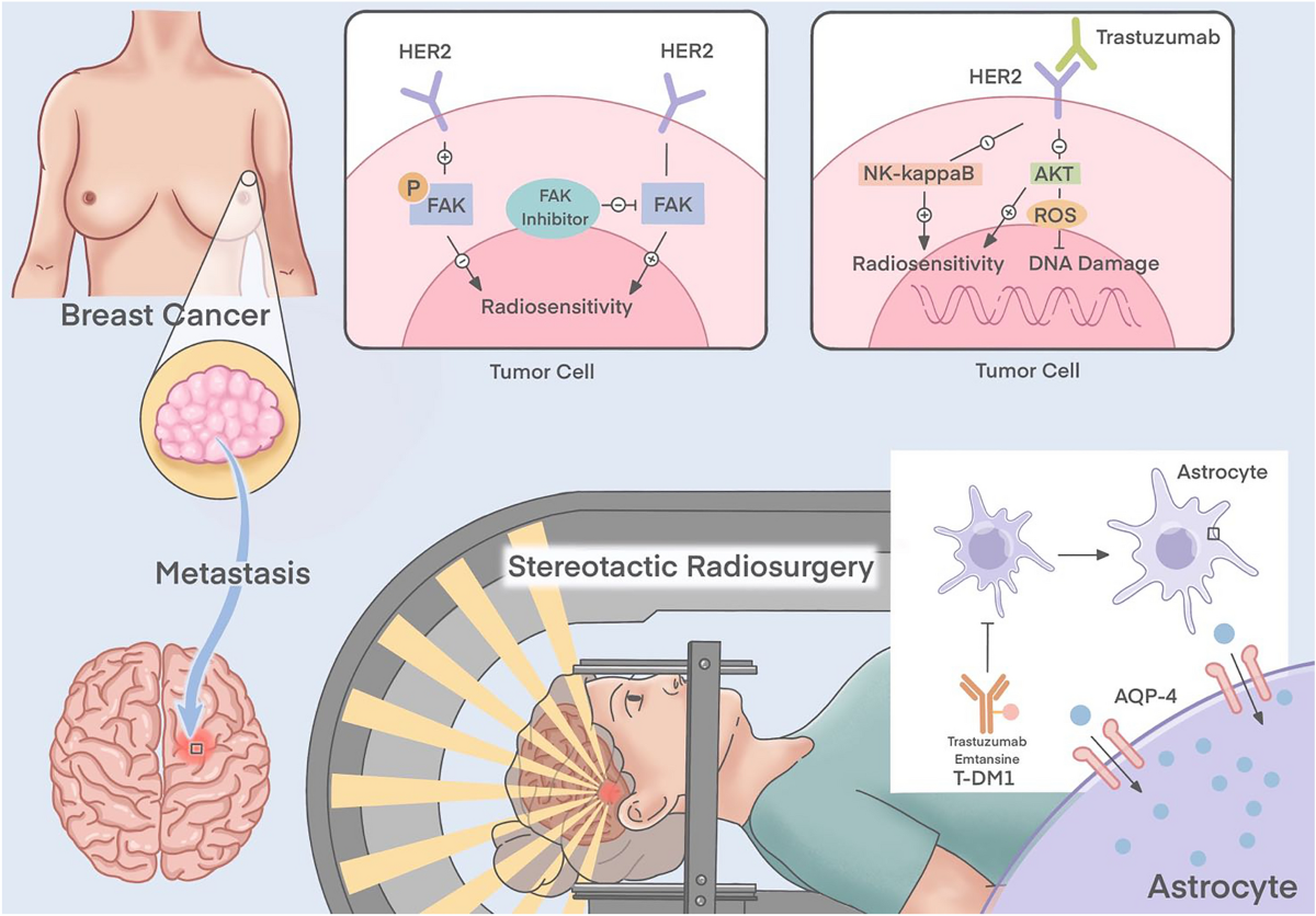 Targeted Therapy for HER2‑Positive Breast Cancer Explained