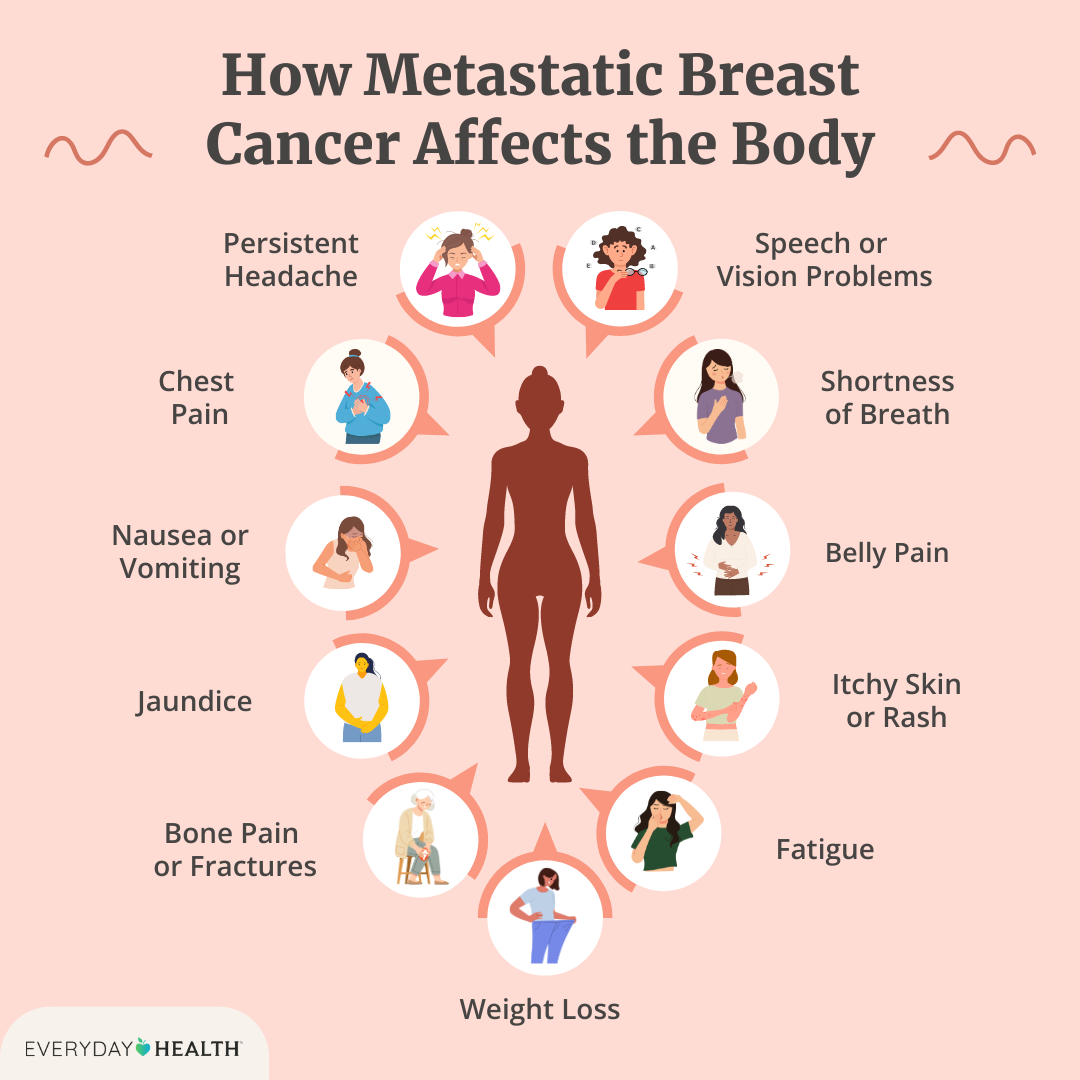 What Are the First Signs of Metastatic Breast Cancer?