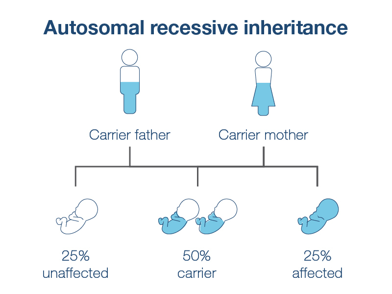 Does NIPT Test for Rett Syndrome? Essential Answers