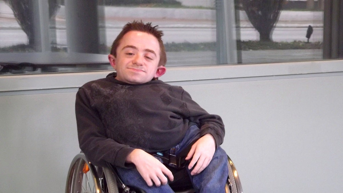 Rare Genetic Bone Disorders – What You Need to Know